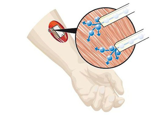 chemical-circuit-arm-diagram-thumb-550xauto-92509.jpg