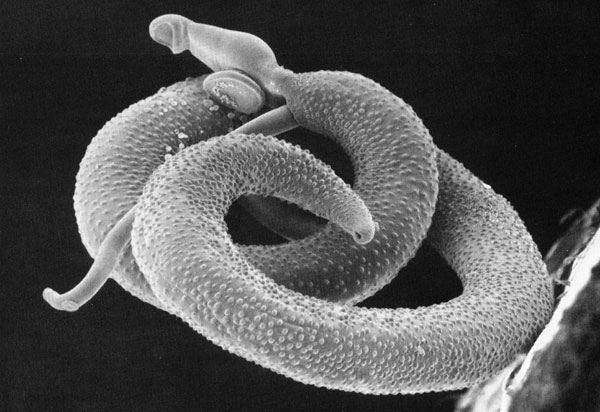 Schistosoma_mansoni2.jpg