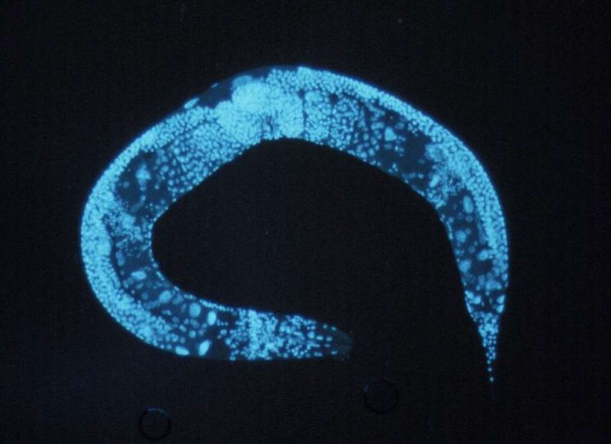enlarged_c_elegans.jpg